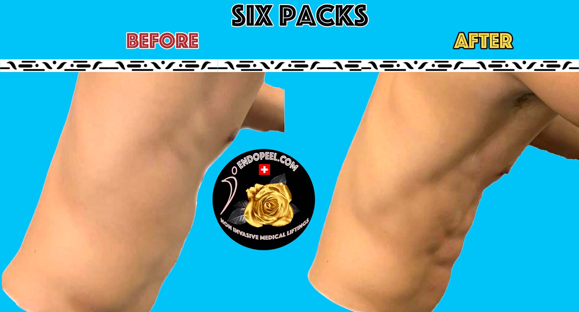 six packs made by endopeel