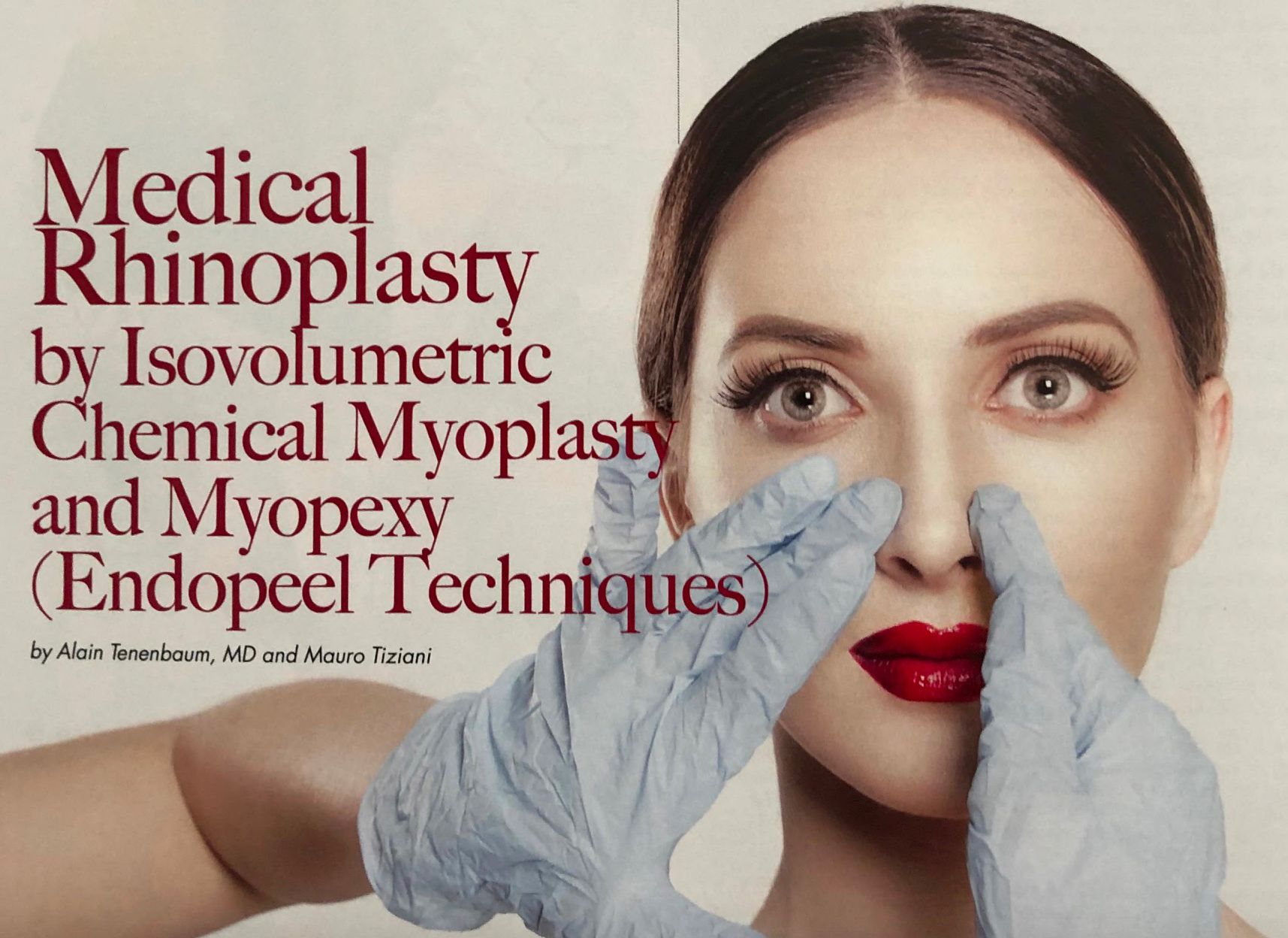 medical-rhinoplasty-publication